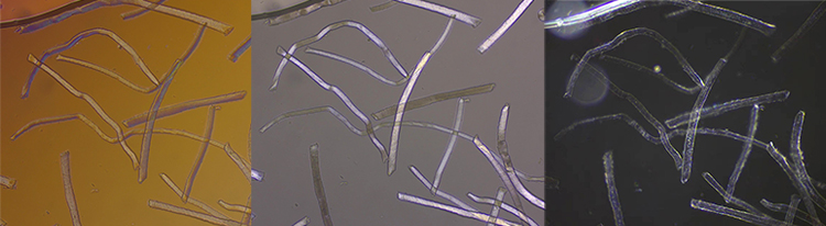 显微镜下混合纤维鉴别